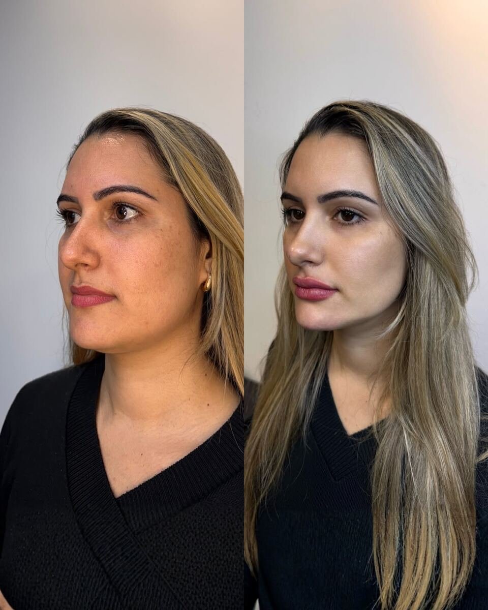Antes e depois - transformação facial
