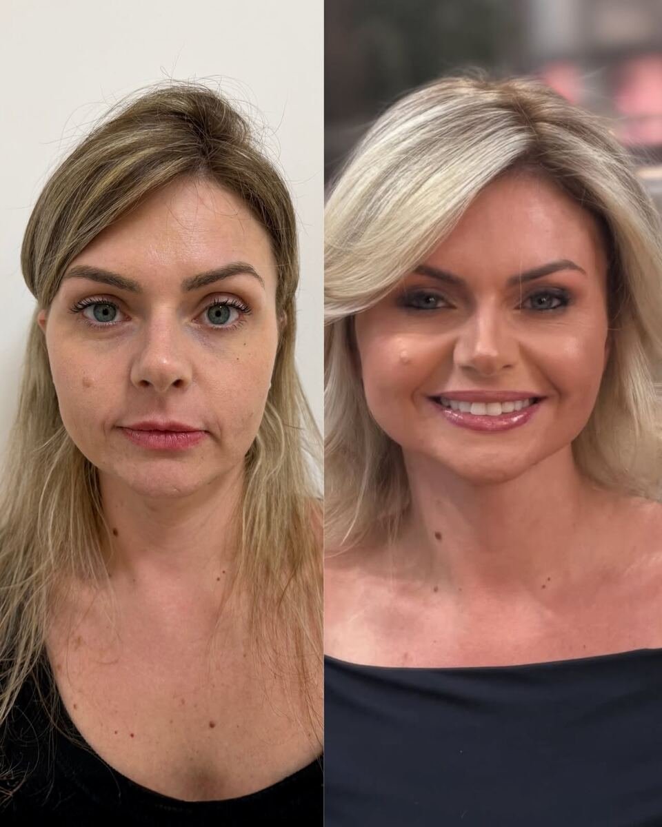 Antes e depois - transformação facial